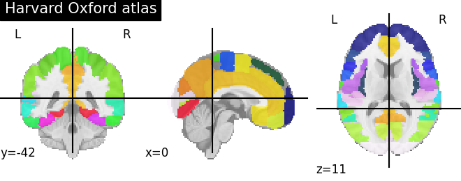 ../_images/sphx_glr_plot_atlas_001.png