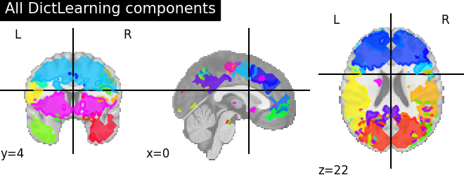 ../_images/sphx_glr_plot_compare_decomposition_022.png