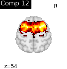 plot compare decomposition