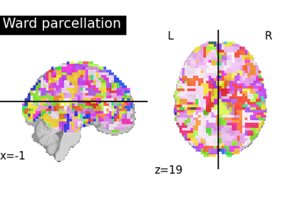 Clustering methods to learn a brain parcellation from fMRI