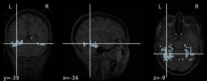 ../_images/sphx_glr_plot_decoding_tutorial_001.png