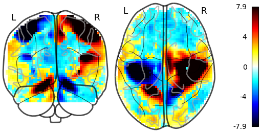 plot demo glass brain extensive