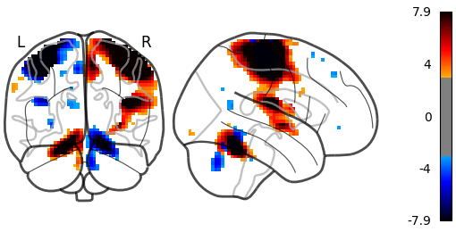 plot demo glass brain extensive