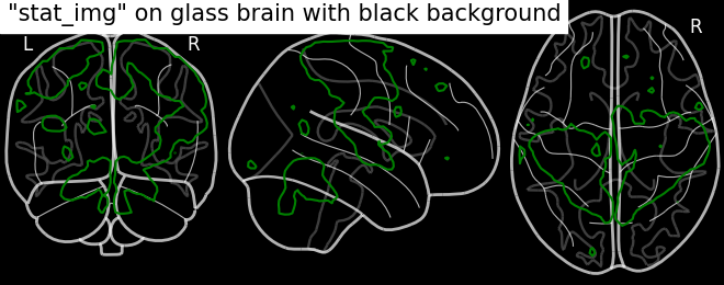 plot demo glass brain extensive