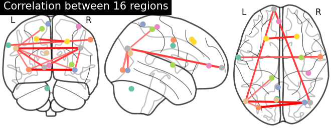 connectome