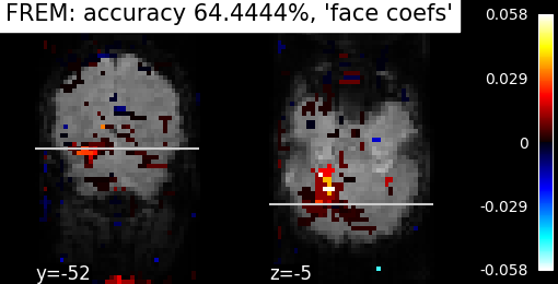 ../_images/sphx_glr_plot_haxby_frem_001.png