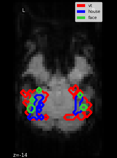 ../_images/sphx_glr_plot_haxby_masks_001.png