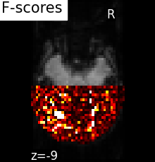 ../_images/sphx_glr_plot_haxby_searchlight_002.png