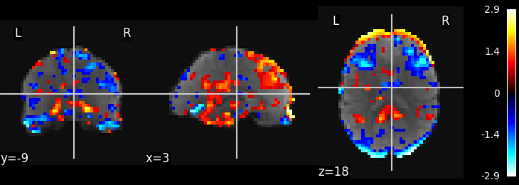 plot ica resting state