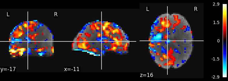 plot ica resting state