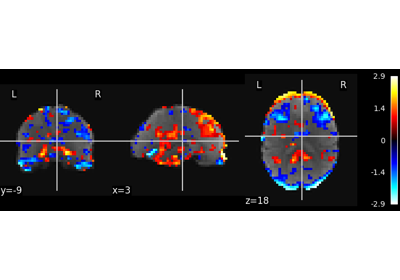 Multivariate decompositions: Independent component analysis of fMRI