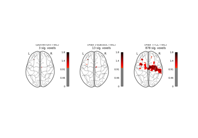 Massively univariate analysis of a motor task from the Localizer dataset