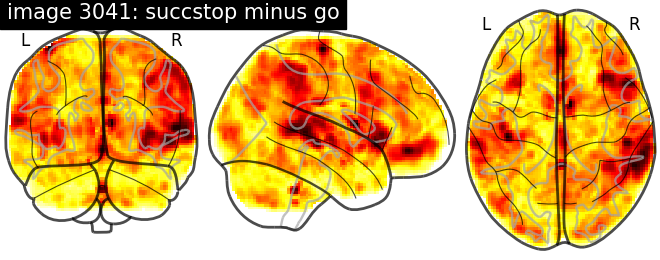 plot neurovault meta analysis