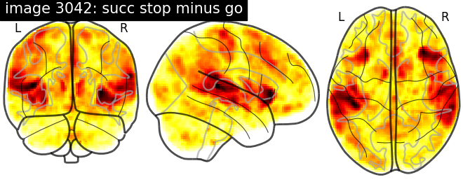 plot neurovault meta analysis