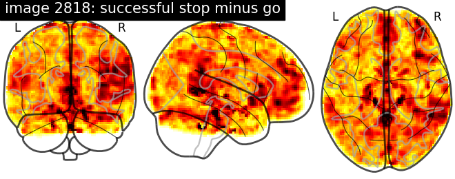 plot neurovault meta analysis