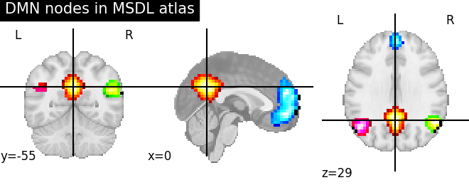 ../_images/sphx_glr_plot_overlay_001.png