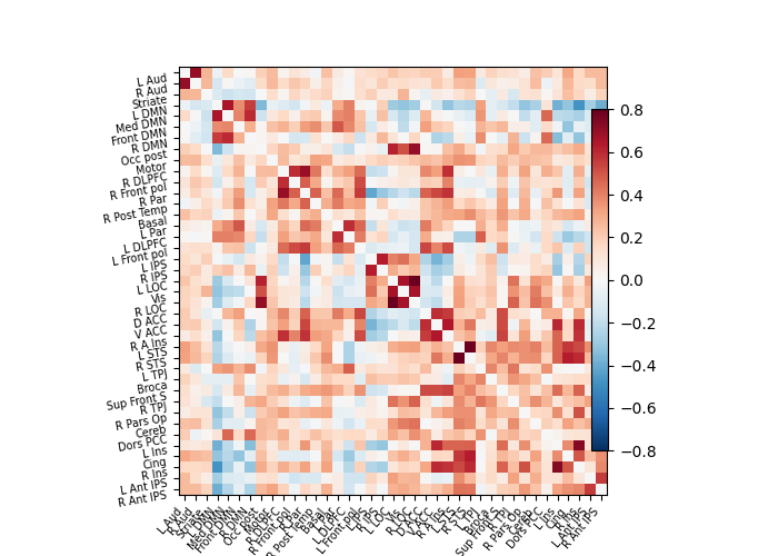 ../_images/sphx_glr_plot_probabilistic_atlas_extraction_001.png