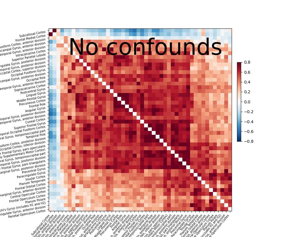 ../_images/sphx_glr_plot_signal_extraction_002.png