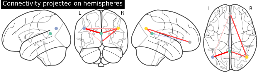 plot_connectome