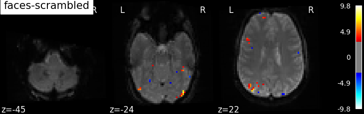 ../_images/sphx_glr_plot_spm_multimodal_faces_001.png