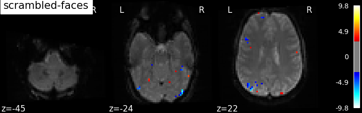 ../_images/sphx_glr_plot_spm_multimodal_faces_002.png