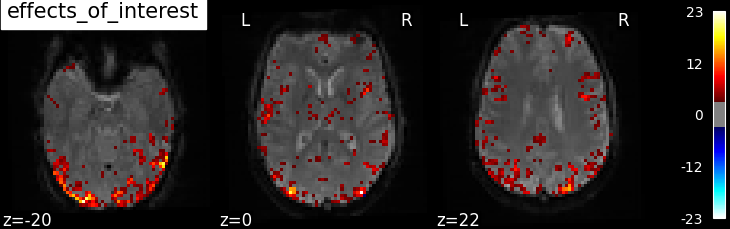 plot spm multimodal faces